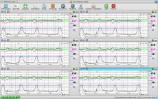 Logiciel PC MFM-CNS Lite pour cardiotocographe Edan F3