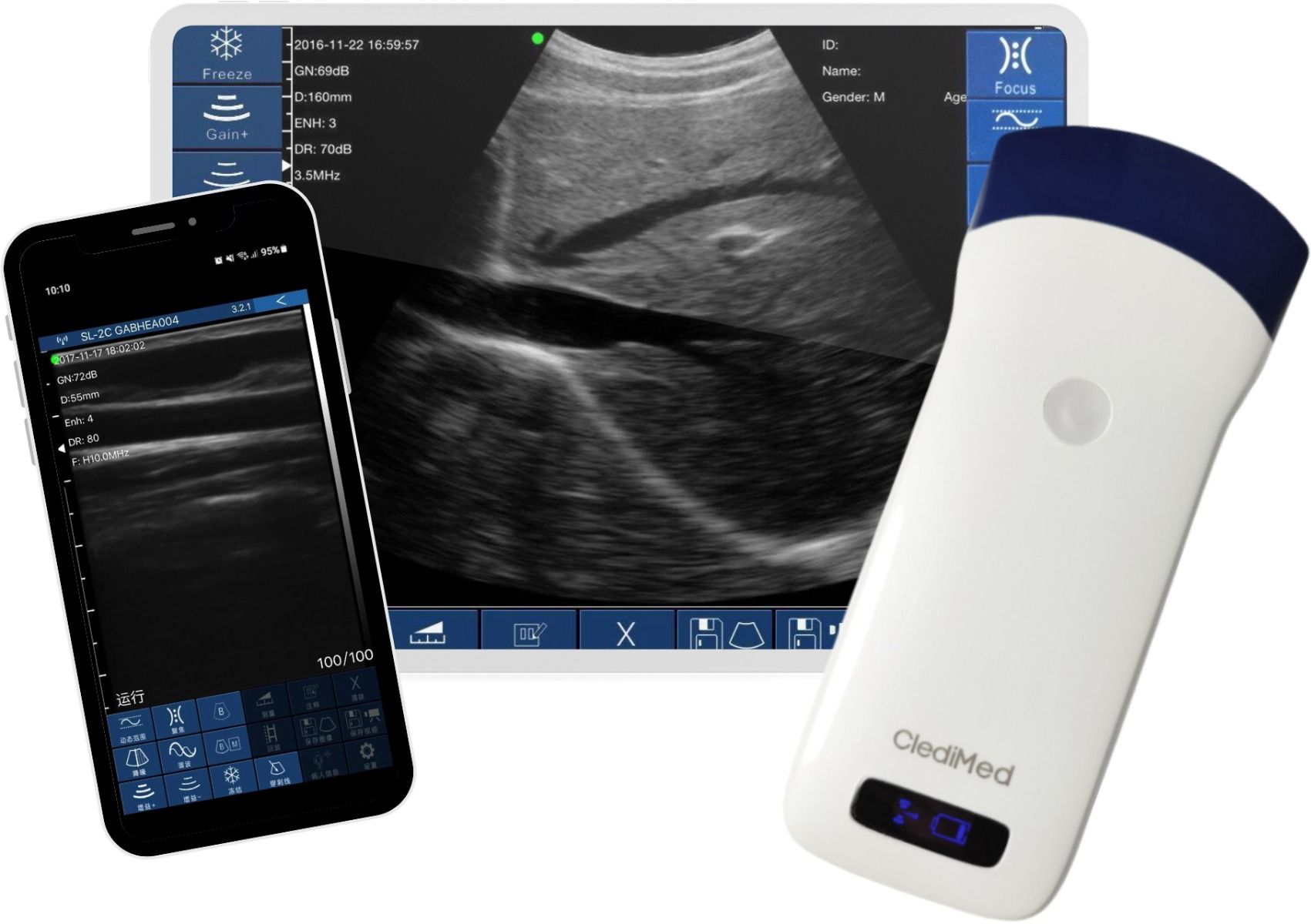 Echographe portable : une révolution en imagerie médicale