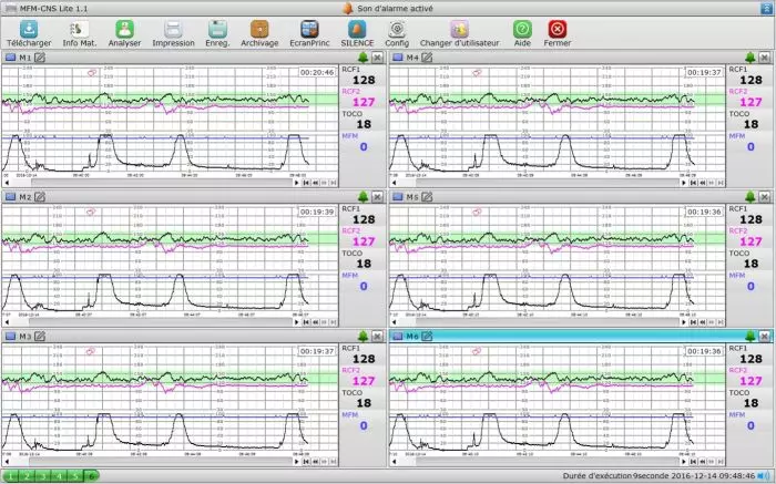 Logiciel PC MFM-CNS Lite pour cardiotocographe Edan F3
