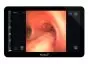 Moniteur portatif pour endoscopie Ambu aView 2 Advance