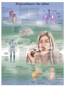 Planche anatomique la dépendance du tabac VR2793L